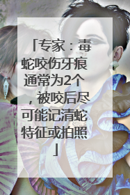 专家：毒蛇咬伤牙痕通常为2个，被咬后尽可能记清蛇特征或拍照